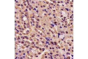 Immunohistochemical analysis of TGase5 staining in rat kidney formalin fixed paraffin embedded tissue section. (Transglutaminase 5 antibody)