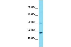 Host: Rabbit  Target Name: Rps23  Sample Tissue: Rat Liver lysates  Antibody Dilution: 1.