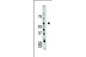 Antibody is used in Western blot to detect PFKFB4 in mouse brain tissue lysate. (PFKFB4 antibody  (AA 266-296))