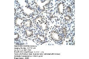 Immunohistochemistry (IHC) image for anti-Heterogeneous Nuclear Ribonucleoprotein A/B (HNRNPAB) (C-Term) antibody (ABIN2776585)