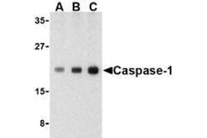 Western blot analysis of Caspase-1 in human heart cell lysate with AP30187PU-N Caspase-1 antibody at (A) 0. (Caspase 1 antibody  (C-Term))