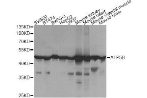 Western blot analysis of extracts of various cell lines, using ATP5B Antibody (ABIN5973391) at 1/1000 dilution. (ATP5B antibody)