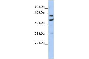 WB Suggested Anti-CNOT6 Antibody Titration:  0. (CNOT6 antibody  (N-Term))