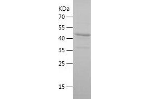 FUT8 Protein (AA 31-256) (His-IF2DI Tag)