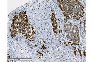 IHC analysis of PTBP2 using anti-PTBP2 antibody (ABIN7599454). (PTBP2 antibody  (AA 1-504))