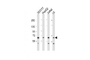 All lanes : Anti-PDP1 Antibody (Center) at 1:2000 dilution Lane 1: 293T/17 whole cell lysate Lane 2: HepG2 whole cell lysate Lane 3: Jurkat whole cell lysate Lane 4: L6 whole cell lysate Lysates/proteins at 20 μg per lane. (PDP antibody  (AA 308-336))