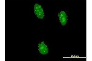 Immunofluorescence of monoclonal antibody to UHRF2 on HeLa cell. (UHRF2 antibody  (AA 81-180))