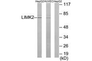 Western blot analysis of extracts from HepG2/HuvEc cells, using LIMK2 Antibody. (LIMK2 antibody  (AA 461-510))