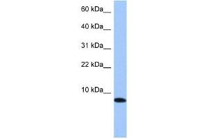 TNP1 antibody used at 1 ug/ml to detect target protein.