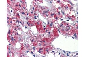 Immunohistochemistry (IHC) image for anti-T-Cell Acute Lymphocytic Leukemia 1 (TAL1) (C-Term) antibody (ABIN184275)