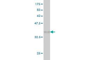 SNCAIP antibody  (AA 206-309)