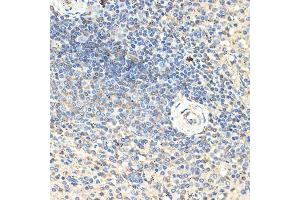 Immunohistochemistry of paraffin-embedded human spleen using CD70 Rabbit pAb (ABIN3022742, ABIN3022743, ABIN3022744, ABIN1512720 and ABIN6219205) at dilution of 1:100 (40x lens). (CD70 antibody  (AA 39-193))