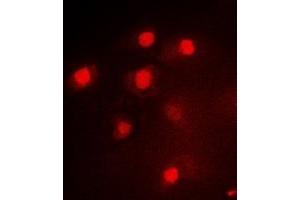 Immunofluorescent analysis of PAX3 staining in Hela cells. (Paired Box 3 antibody)