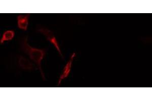ABIN6266907 staining HuvEc cells by IF/ICC. (GUCY1B3 antibody  (N-Term))