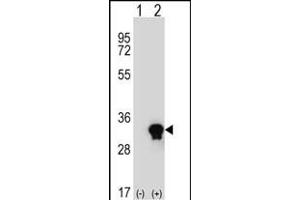 Western blot analysis of C1QTNF6 (arrow) using rabbit polyclonal C1QTNF6 Antibody (N-term) (ABIN652830 and ABIN2842542). (CTRP6 antibody  (N-Term))