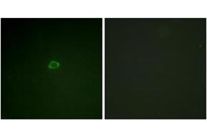 Immunofluorescence analysis of A549 cells, using 4E-BP1 (Ab-36) Antibody. (eIF4EBP1 antibody  (AA 2-51))