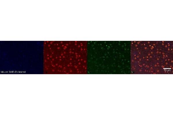TSHZ2 antibody
