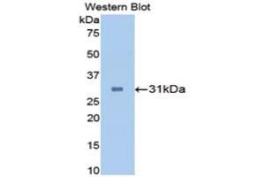 Western Blotting (WB) image for anti-Carbonic Anhydrase II (CA2) (AA 1-260) antibody (ABIN1173596) (CA2 antibody  (AA 1-260))