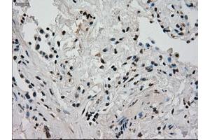 Image no. 10 for anti-Glucokinase (Hexokinase 4) (GCK) antibody (ABIN1498413) (GCK antibody)