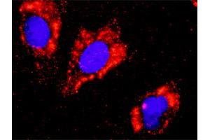 Proximity Ligation Analysis of protein-protein interactions between FLT1 and CTNNB1. (FLT1 antibody  (AA 1-687))