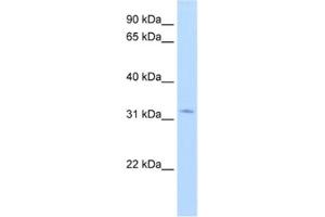 Western Blotting (WB) image for anti-Hydroxysteroid (17-Beta) Dehydrogenase 6 (HSD17B6) antibody (ABIN2462427)