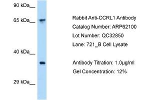 Western Blotting (WB) image for anti-Chemokine (C-C Motif) Receptor-Like 1 (CCRL1) (C-Term) antibody (ABIN2789017) (CCRL1 antibody  (C-Term))