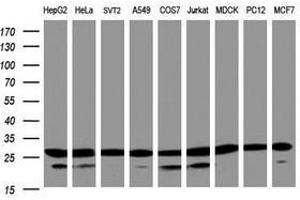 Image no. 3 for anti-Proteasome Subunit alpha 2 (PSMA2) (AA 50-234) antibody (ABIN1491567) (PSMA2 antibody  (AA 50-234))