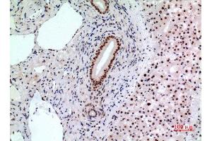 Immunohistochemistry (IHC) analysis of paraffin-embedded Human Liver, antibody was diluted at 1:100. (BCL6 antibody  (Internal Region))