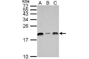 WB Image UBE2L3 antibody detects UBE2L3 protein by Western blot analysis. (UBE2L3 antibody  (C-Term))