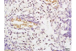 Formalin-fixed and paraffin embedded rat kidney labeled with Anti STK3/MST3 Polyclonal Antibody, Unconjugated (ABIN872978) at 1:200 followed by conjugation to the secondary antibody and DAB staining (STK3,STK4 (AA 101-200) antibody)