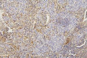 IHC analysis of Collagen III/COL3A1 using anti-Collagen III/COL3A1 antibody (ABIN6719296).