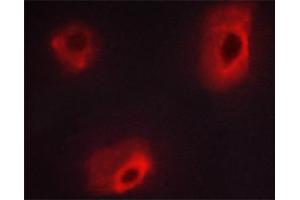 Immunofluorescence (fixed cells) (IF/ICC) image for anti-Caldesmon 1 (CALD1) (pSer789) antibody (ABIN6255507)