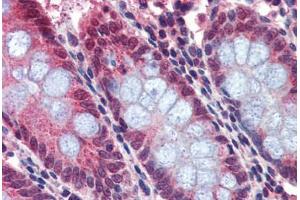 Human Colon: Formalin-Fixed, Paraffin-Embedded (FFPE) (BACE2 antibody  (AA 44-59))