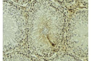 ABIN6277188 at 1/100 staining Mouse testis tissue by IHC-P. (UHRF1 antibody  (N-Term))