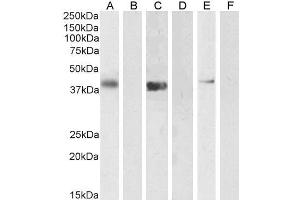ABIN190768 (1µg/ml) staining of U2OS (A) + peptide (B), (0. (PTF1A antibody  (Internal Region))