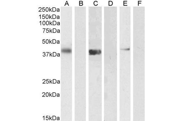 PTF1A antibody  (Internal Region)