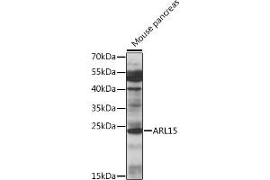 Western blot analysis of extracts of mouse pancreas, using  antibody (ABIN7265491) at 1:1000 dilution.