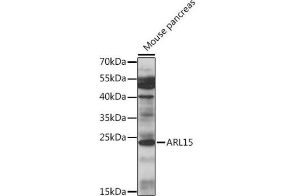 ARL15 antibody  (AA 1-204)