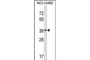 TP53TG5 Antibody (Center) (ABIN1537832 and ABIN2849793) western blot analysis in NCI- cell line lysates (35 μg/lane). (TP53TG5 antibody  (AA 134-161))