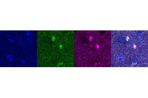 Immunohistochemistry (IHC) image for anti-Oligodendrocyte Lineage Transcription Factor 2 (OLIG2) antibody (ABIN7456250) (OLIG2 antibody)