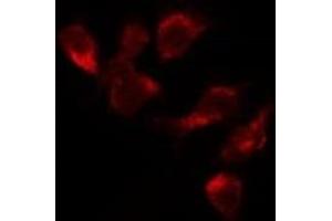 ABIN6277698 staining Hela by IF/ICC. (MSH3 antibody  (N-Term))