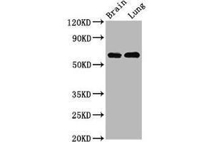 Western Blot Positive WB detected in: Rat brain tissue, Rat lung tissue All lanes: SELENON antibody at 4. (Selenoprotein N antibody  (AA 135-219))