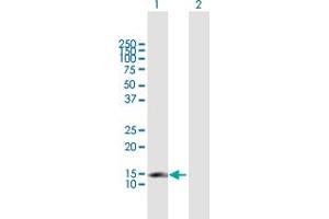 Western Blot analysis of CDKN2C expression in transfected 293T cell line by CDKN2C MaxPab polyclonal antibody.