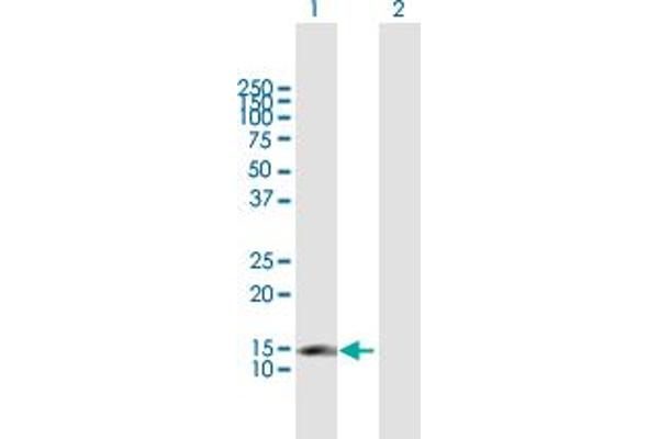 CDKN2C anticorps  (AA 1-168)