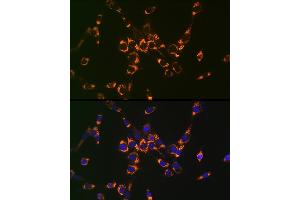Immunofluorescence analysis of NIH-3T3 cells using ASL Rabbit pAb (ABIN6127448, ABIN6137201, ABIN6137202 and ABIN6221972) at dilution of 1:100 (40x lens). (ASL antibody  (AA 1-300))