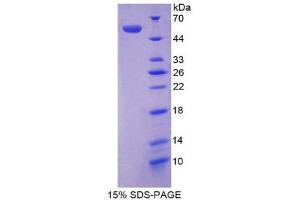 SDS-PAGE (SDS) image for Angiotensinogen (serpin Peptidase Inhibitor, Clade A, Member 8) (AGT) (AA 23-477) protein (His tag) (ABIN1078809)