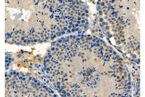 ABIN6257551 and ABIN6275682 at 1/100 staining Mouse testis tissue by IHC-P. (WASF2 antibody  (Internal Region))