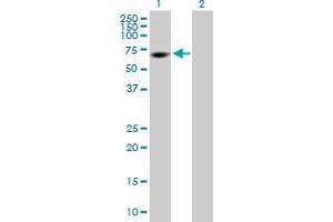 Western Blot analysis of MPP2 expression in transfected 293T cell line by MPP2 MaxPab polyclonal antibody. (MPP2 antibody  (AA 1-552))