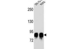 Western Blotting (WB) image for anti-Protein-O-Mannosyltransferase 1 (POMT1) antibody (ABIN2996702)