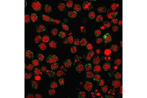 Immunofluorescence staining of U937 cells using CD15 Rabbit Recombinant Monoclonal Antibody (FUT4/1478R) followed by goat anti-Mouse IgG conjugated to CF488 (green).
